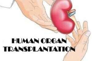 Transplantation-Of-Human-Organs-&-Tissues-Act-No-Bar-To-Enquiry-For-Professional-Misconduct-Under-IMC-Ethics-Regulations-2002-The-Law-Communicants